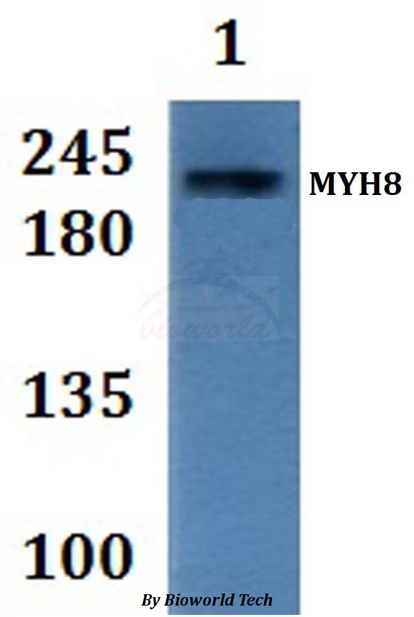 MYH8 Antibody - Western blot of MYH8 antibody at 1:500 dilution Line1:HEPG2 whole cell lysate.