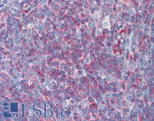 MYH9 Antibody - Anti-MYH9 antibody IHC of human tonsil. Immunohistochemistry of formalin-fixed, paraffin-embedded tissue after heat-induced antigen retrieval. Antibody concentration 5 ug/ml.  This image was taken for the unconjugated form of this product. Other forms have not been tested.