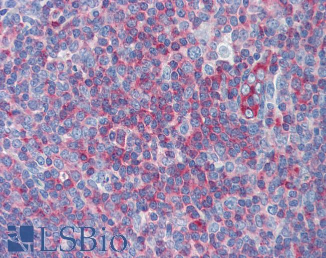 MYH9 Antibody - Anti-MYH9 antibody IHC of human tonsil. Immunohistochemistry of formalin-fixed, paraffin-embedded tissue after heat-induced antigen retrieval. Antibody concentration 5 ug/ml.  This image was taken for the unconjugated form of this product. Other forms have not been tested.