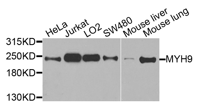MYH9 Antibody - Western blot analysis of extracts of various cell lines, using MYH9 antibody at 1:1000 dilution. The secondary antibody used was an HRP Goat Anti-Rabbit IgG (H+L) at 1:10000 dilution. Lysates were loaded 25ug per lane and 3% nonfat dry milk in TBST was used for blocking. An ECL Kit was used for detection and the exposure time was 15s.