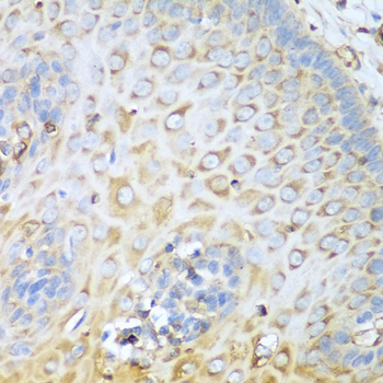 MYH9 Antibody - Immunohistochemistry of paraffin-embedded human esophagus using MYH9 antibodyat dilution of 1:100 (40x lens).