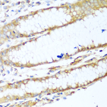 MYH9 Antibody - Immunohistochemistry of paraffin-embedded human stomach using MYH9 antibodyat dilution of 1:100 (40x lens).