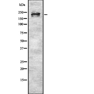 MYH9 Antibody - Western blot analysis of MYH9 using Jurkat whole cells lysates