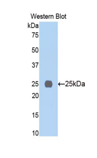 MYHC / MYH6 Antibody - Western blot of recombinant MYHC / MYH6.  This image was taken for the unconjugated form of this product. Other forms have not been tested.