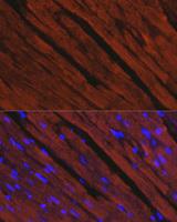MYHC / MYH6 Antibody - Immunofluorescence analysis of Rat heart using MYH6 Polyclonal Antibody at dilution of 1:100.Blue: DAPI for nuclear staining.