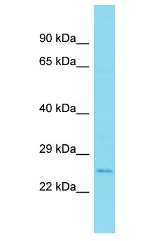 MYL10 Antibody - MYL10 antibody Western Blot of 721_B. Antibody dilution: 1 ug/ml.  This image was taken for the unconjugated form of this product. Other forms have not been tested.