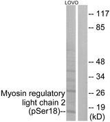 MYL12A / MRCL3 Antibody - Western blot analysis of extracts from LOVO cells, treated with H2O2 (100uM, 30mins), using Myosin regulatory light chain 2 (Phospho-Ser18) antibody.