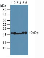 MYL2 Antibody - Western Blot; Sample: Lane1: Human Serum; Lane2: Rat Heart Tissue; Lane3: Rat Skin Tissue; Lane4: Rat Skeletal Muscle Tissue; Lane5: Mouse Heart Tissue; Lane6: Porcine Heart Tissue.