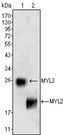 MYL2 Antibody - MYL2 Antibody in Western Blot (WB)