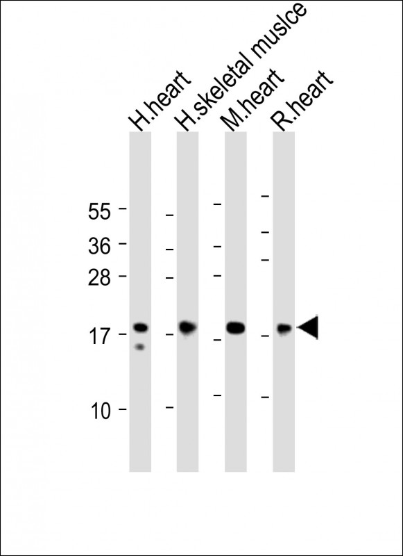 MYL2 Antibody - All lanes: Anti-MYL2 Antibody (Center) at 1:2000 dilution Lane 1: Human heart lysate Lane 2: Human skeletal muslce lysate Lane 3: Mouse heart lysate Lane 4: Rat heart lysate Lysates/proteins at 20 µg per lane. Secondary Goat Anti-Rabbit IgG, (H+L), Peroxidase conjugated at 1/10000 dilution. Predicted band size: 19 kDa Blocking/Dilution buffer: 5% NFDM/TBST.