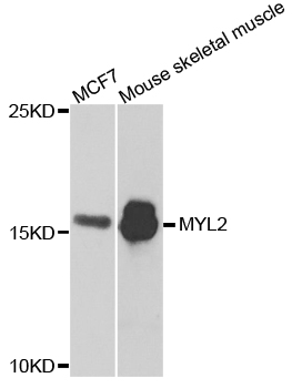 MYL2 Antibody - Western blot analysis of extracts of MCF7 cells and mouse tissues.