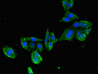 MYL2 Antibody - Immunofluorescent analysis of HepG2 cells using MYL2 Antibody at dilution of 1:100 and Alexa Fluor 488-congugated AffiniPure Goat Anti-Rabbit IgG(H+L)