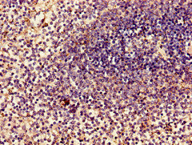MYL2 Antibody - Immunohistochemistry of paraffin-embedded human spleen tissue using MYL2 Antibody at dilution of 1:100