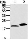 MYL2 Antibody - Western blot analysis of Mouse skin and heart tissue, using MYL2 Polyclonal Antibody at dilution of 1:800.
