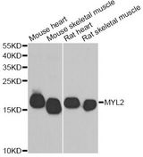 MYL2 Antibody - Western blot analysis of extracts of various cell lines, using MYL2 antibody at 1:500 dilution. The secondary antibody used was an HRP Goat Anti-Rabbit IgG (H+L) at 1:10000 dilution. Lysates were loaded 25ug per lane and 3% nonfat dry milk in TBST was used for blocking. An ECL Kit was used for detection and the exposure time was 90s.