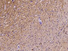 MYL2 Antibody - Immunochemical staining of mouse MYL2 in mouse heart with rabbit polyclonal antibody at 1:1000 dilution, formalin-fixed paraffin embedded sections.