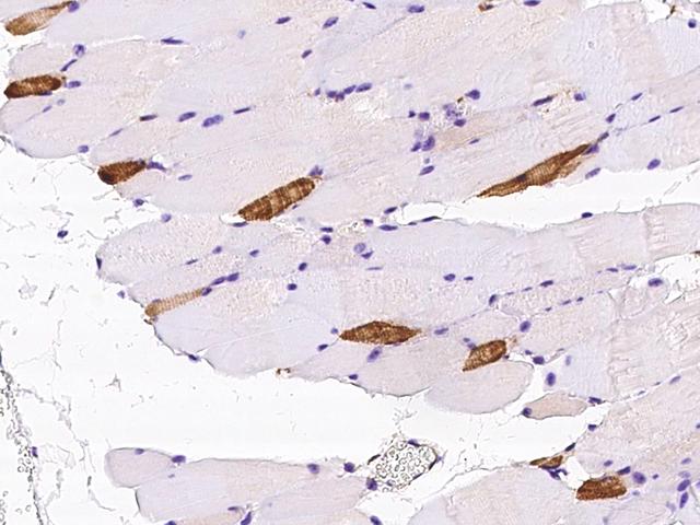 MYL2 Antibody - Immunochemical staining of mouse MYL2 in mouse skeletal muscle with rabbit polyclonal antibody at 1:1000 dilution, formalin-fixed paraffin embedded sections.