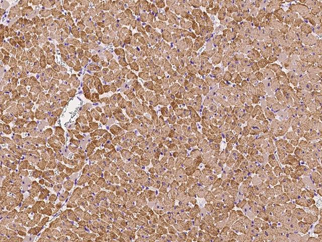 MYL2 Antibody - Immunochemical staining of mouse MYL2 in rat heart with rabbit polyclonal antibody at 1:1000 dilution, formalin-fixed paraffin embedded sections.