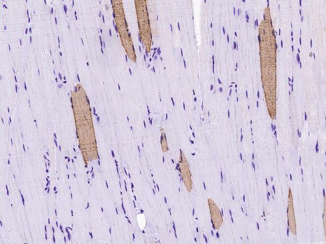 MYL2 Antibody - Immunochemical staining of mouse MYL2 in rat skeletal muscle with rabbit polyclonal antibody at 1:1000 dilution, formalin-fixed paraffin embedded sections.