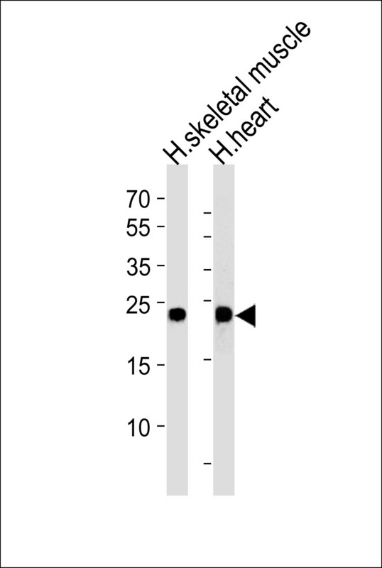MYL3 Antibody - Western blot of lysates from human skeletal muscle and heart tissue lysates (from left to right), using MYL3 Antibody. Antibody was diluted at 1:1000 at each lane. A goat anti-rabbit IgG H&L (HRP) at 1:5000 dilution was used as the secondary antibody. Lysates at 35ug per lane.