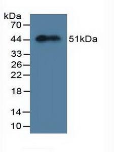 MYL3 Antibody - Western Blot; Sample: Recombinant MYL3, Mouse.