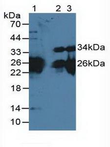 MYL3 Antibody - Western Blot; Sample: Lane1:Mouse Heart Tissue; Lane2: Mouse Skeletal Muscle Tissue; Lane3: Rat Skeletal Muscle Tissue.