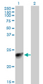 MYL3 Antibody - Western Blot analysis of MYL3 expression in transfected 293T cell line by MYL3 monoclonal antibody (M12), clone 4C2.Lane 1: MYL3 transfected lysate(21.9 KDa).Lane 2: Non-transfected lysate.