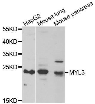 MYL3 Antibody - Western blot analysis of extracts of various cell lines.