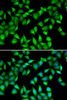 MYL3 Antibody - Immunofluorescence analysis of U20S cells.