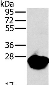 MYL3 Antibody - Western blot analysis of Mouse heart tissue, using MYL3 Polyclonal Antibody at dilution of 1:650.