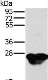 MYL3 Antibody - Western blot analysis of Mouse heart tissue, using MYL3 Polyclonal Antibody at dilution of 1:500.