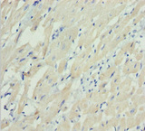 MYL3 Antibody - Immunohistochemistry of paraffin-embedded human heart tissue at dilution 1:100