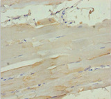 MYL3 Antibody - Immunohistochemistry of paraffin-embedded human skeletal muscle tissue at dilution 1:100
