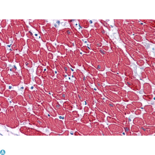 MYL3 Antibody - Immunohistochemistry (IHC) analysis of paraffin-embedded Human Heart tissues with AEC staining using MYL3 Monoclonal Antibody.