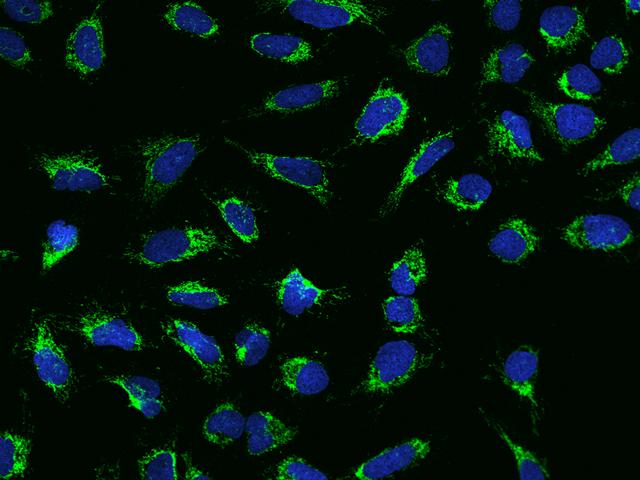 MYL3 Antibody - Immunofluorescence staining of MYL3 in U2OS cells. Cells were fixed with 4% PFA, permeabilzed with 0.1% Triton X-100 in PBS, blocked with 10% serum, and incubated with rabbit anti-Human MYL3 polyclonal antibody (dilution ratio 1:200) at 4°C overnight. Then cells were stained with the Alexa Fluor 488-conjugated Goat Anti-rabbit IgG secondary antibody (green) and counterstained with DAPI (blue). Positive staining was localized to Cytoplasm.
