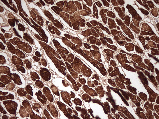 MYL4 Antibody - Immunohistochemical staining of paraffin-embedded Human adult heart tissue using anti-MYL4 mouse monoclonal antibody. (Heat-induced epitope retrieval by 1 mM EDTA in 10mM Tris, pH8.5, 120C for 3min,