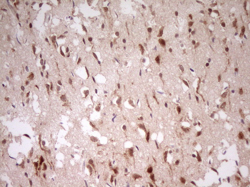 MYL4 Antibody - Immunohistochemical staining of paraffin-embedded Human adult brain tissue using anti-MYL4 mouse monoclonal antibody. (Heat-induced epitope retrieval by 1 mM EDTA in 10mM Tris, pH8.5, 120C for 3min,