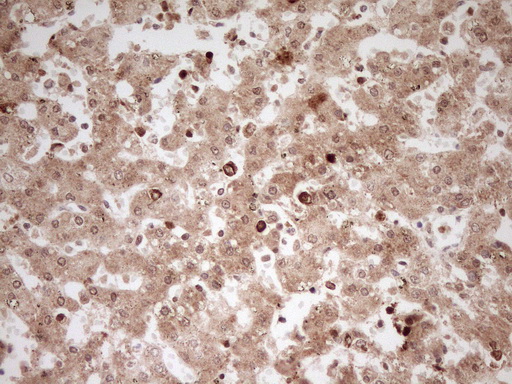 MYL4 Antibody - Immunohistochemical staining of paraffin-embedded Human embryonic liver tissue using anti-MYL4 mouse monoclonal antibody. (Heat-induced epitope retrieval by 1 mM EDTA in 10mM Tris, pH8.5, 120C for 3min,