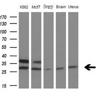 MYL4 Antibody - Western blot analysis of extracts. (10ug) from 3 different cell lines and 2 human tissue by using anti-MYL4 monoclonal antibody at 1:200 dilution.