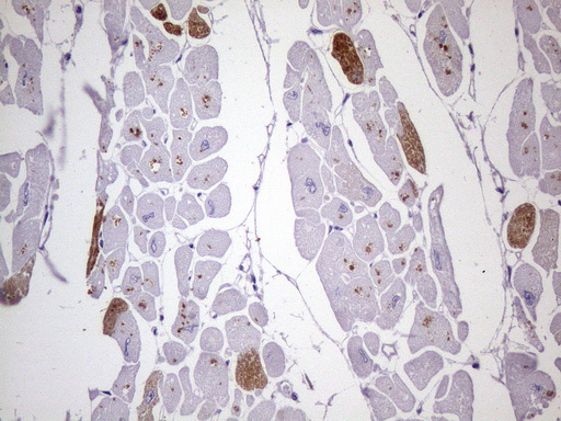 MYL4 Antibody - Immunohistochemical staining of paraffin-embedded Human adult heart tissue using anti-MYL4 mouse monoclonal antibody. (Heat-induced epitope retrieval by 1 mM EDTA in 10mM Tris, pH8.5, 120C for 3min. (1:150)