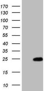 MYL4 Antibody - HEK293T cells were transfected with the pCMV6-ENTRY control (Left lane) or pCMV6-ENTRY MYL4 (Right lane) cDNA for 48 hrs and lysed. Equivalent amounts of cell lysates (5 ug per lane) were separated by SDS-PAGE and immunoblotted with anti-MYL4 (1:2000).