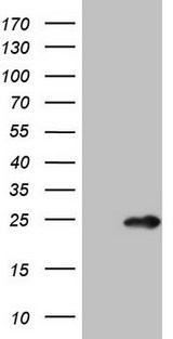 MYL4 Antibody - HEK293T cells were transfected with the pCMV6-ENTRY control (Left lane) or pCMV6-ENTRY MYL4 (Right lane) cDNA for 48 hrs and lysed. Equivalent amounts of cell lysates (5 ug per lane) were separated by SDS-PAGE and immunoblotted with anti-MYL4.