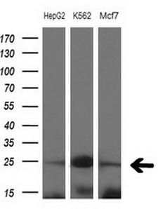 MYL4 Antibody - Western blot of extracts (10ug) from 3 different cell lines by using anti-MYL4 monoclonal antibody at 1:200 dilution.