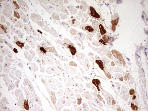 MYL4 Antibody - Immunohistochemical staining of paraffin-embedded Human adult heart tissue using anti-MYL4 mouse monoclonal antibody. (Heat-induced epitope retrieval by 1 mM EDTA in 10mM Tris, pH8.5, 120C for 3min,