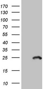 MYL4 Antibody - HEK293T cells were transfected with the pCMV6-ENTRY control (Left lane) or pCMV6-ENTRY MYL4 (Right lane) cDNA for 48 hrs and lysed. Equivalent amounts of cell lysates (5 ug per lane) were separated by SDS-PAGE and immunoblotted with anti-MYL4.