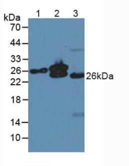 MYL4 Antibody - Western Blot; Sample: Lane1: Human Liver Tissue; Lane2: Mouse Heart Tissue; Lane3: Mouse Skeletal Muscle Tissue.