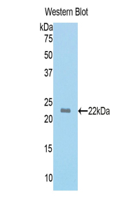 MYL4 Antibody - Western blot of recombinant MYL4 / GT1.  This image was taken for the unconjugated form of this product. Other forms have not been tested.