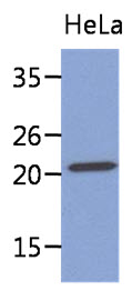MYL4 Antibody - Western Blot: The lysate of HeLa (40 ug) were resolved by SDS-PAGE, transferred to PVDF membrane and probed with anti-human MYL4 antibody (1:1000). Proteins were visualized using a goat anti-mouse secondary antibody conjugated to HRP and an ECL detection system.