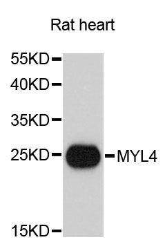 MYL4 Antibody - Western blot analysis of extracts of rat heart, using MYL4 antibody at 1:3000 dilution. The secondary antibody used was an HRP Goat Anti-Rabbit IgG (H+L) at 1:10000 dilution. Lysates were loaded 25ug per lane and 3% nonfat dry milk in TBST was used for blocking. An ECL Kit was used for detection and the exposure time was 90s.