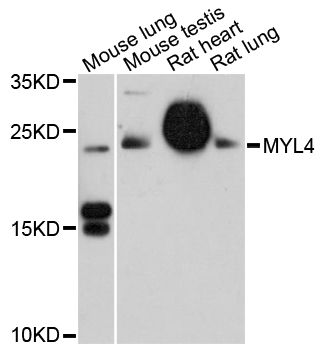 MYL4 Antibody - Western blot analysis of extracts of various cell lines, using MYL4 antibody at 1:3000 dilution. The secondary antibody used was an HRP Goat Anti-Rabbit IgG (H+L) at 1:10000 dilution. Lysates were loaded 25ug per lane and 3% nonfat dry milk in TBST was used for blocking. An ECL Kit was used for detection and the exposure time was 10s.